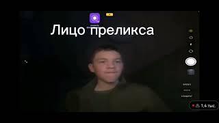 прелекс циган Спалил лицо на стриме!