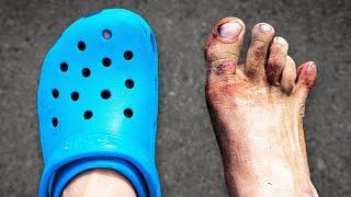 I Ran a Marathon in Crocs