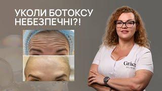  УКОЛИ БОТОКСУ НЕБЕЗПЕЧНІ?! | УСКЛАДНЕННЯ ПІСЛЯ БОТОКСУ | Grace