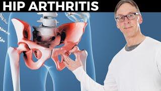 How Bob Relieves His Hip Arthritis In 10 Minutes