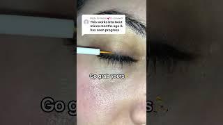 Best lash serum