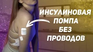 ПРОРЫВ В ДИАБЕТЕ? / Инсулиновая помпа без проводов / Новый мониторинг Medtrum