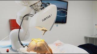 ARTAS® Hair Restoration Technology | Care4Hair