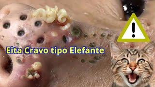 REMOVENDO ESPINHAS E CRAVOS SATISFATÓRIO #020
