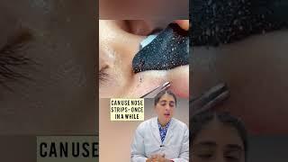 Blackhead removal | Nose blackhead | Nose blackhead removal | Pore strips #skincare