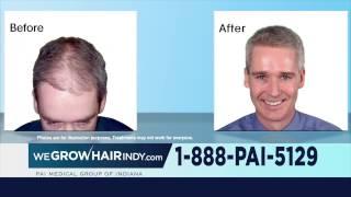 Hair Transplant and Hair Treatment Programs | PAI Medical Group (60sec)
