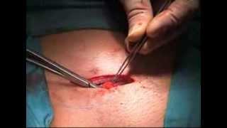 ARGUS Surgery