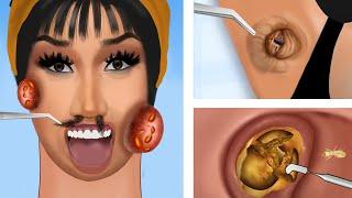 [ASMR Animation] Remove Lisa's  Blackhead & skin wart | Care for sensitive skin in a mask