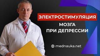 Электростимуляция мозга при депрессии