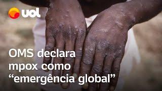 OMS declara mpox como 'emergência global', a primeira desde covid-19