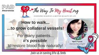 Peripheral Artery Disease: How To Grow Collateral Vessels by Walking