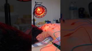 ASMR: Incredible Chinese Electric Acupuncture Chiropractic and Cupping Massage #shorts