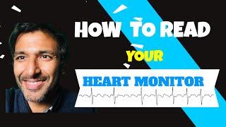 How to read your heart monitor trace