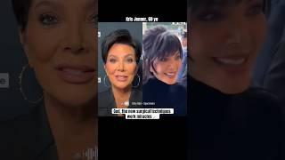 The new surgeons are magicians 🪄#krisjenner #kardashians #celeb #celebrity #surgery #beforeafter