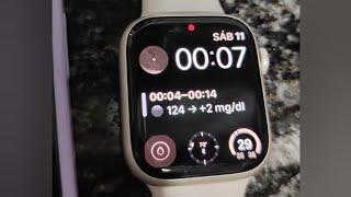 Ver glucemias en un Apple Watch usando la app Shuggah (iPhone)