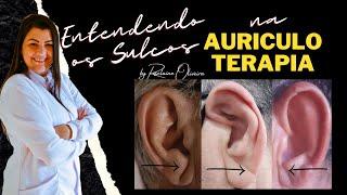 #26  Entendendo os SULCOS na AURICULOTERAPIA