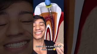 Canal no dente. ASSIM que é feito !! #shorts