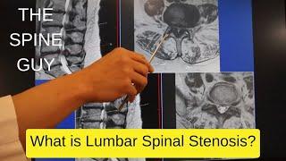 Part 1 - What is Lumbar Spinal Stenosis?