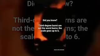 Well now we know #burn #fire #degree #fypシ #fyp #shorts #viral