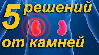 Растворить камни в почках и мочевом пузыре / 5 рецептов