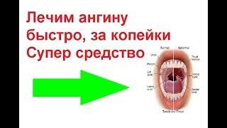 Лучшее и безопасное средство от ангины 100%