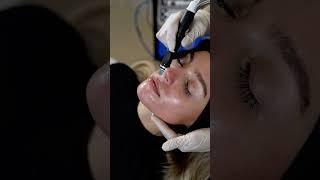 HydraFacial Treatment at London Aesthetics Clinic | Instant Glow & Skin Rejuvenation #hydrafacial