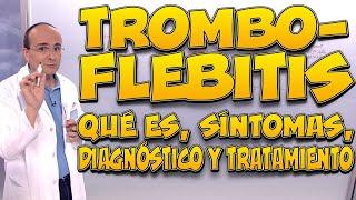 TROMBOFLEBITIS - Qué es, síntomas, diagnóstico y tratamiento