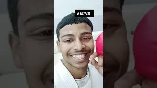 Gold Medal  #karate #kumite #practice #gold #medal #shorts #viral #trending