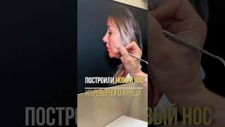 РИНОПЛАСТИКА В МАХАЧКАЛЕ - АЛИ РАДЖАБОВИЧ  +7 (988) 292-51-15 клиника Эстет пластик