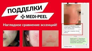 ОРИГИНАЛ и ПОДДЕЛКА бренда MEDI-PEEL