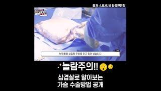 [210만]#SHORTS [가슴성형] 가슴성형 과정