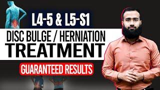 Get Rid Of L4 L5 And L5 S1 Disc Bulge With This Home Treatment | Guaranteed Results!