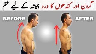 The Best Exercises For Bad Posture At Home (FIX HUNCHBACK!)