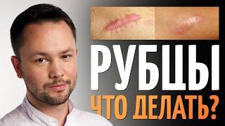 Шрамы (Рубцы). Как избавиться? Обзор методов от врача косметолога.