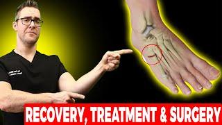 5th Metatarsal Jones Fracture [Recovery, Treatment & Surgery]