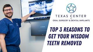 Top 3 Reasons To Get Your Wisdom Teeth Removed