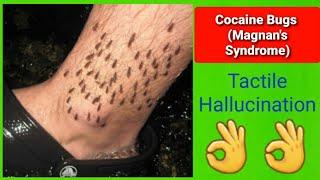 Cocaine Bugs || Magnan's Syndrome