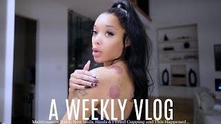 WEEKLY VLOG | I Tried Cupping and This Happened + New Nails & Hauls