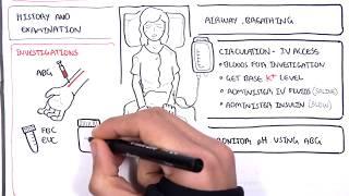 Diabetic Ketoacidosis (Diabetes Type I) Management Summary