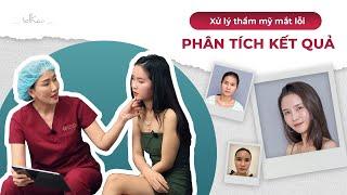 [Bác sĩ Thảo] [LIVESTREAM] PHÂN TÍCH KẾT QUẢ THẨM MỸ CỦA KHÁCH HÀNG