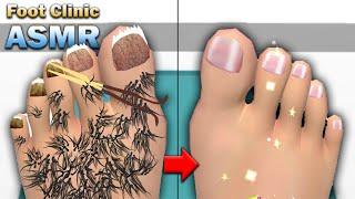 MAX LEVEL in Foot Clinic - ASMR Feet Care iOS/Android Game