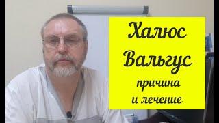 Халюс Вальгус (Hallux valgus). Настоящая причина данной проблемы.