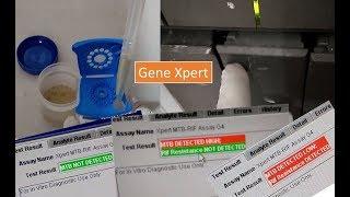 GeneXpert introduction, procedure and its application