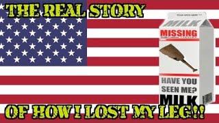 HOW I LOST MY LEG!! IN THE USA!!