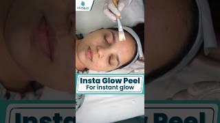 InstaGlow Peel : Your Shortcut to Instant Glow | SkinQure