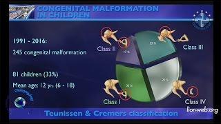 The 18th Causse Otology Course 2016 Lecture Congenital malformation in children Robert Vincent