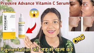 ProSKire Vitamin C Serum Review,proskire vitamin c serum 2024|proskire vitamin c serum how to use