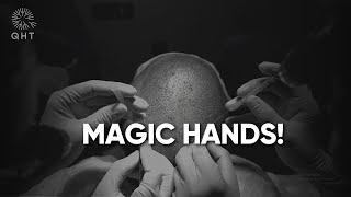 Magic Hands at QHT Clinic Haridwar | Best Hair Transplant Result In India | QHT Clinic