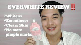 EVERWHITE REVIEW| Rex Novida