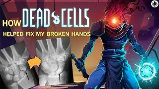 Why Deadcells is still worth it | review 2022